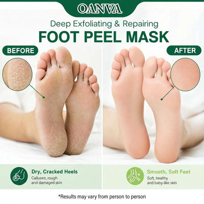 Oanva Foot Peeling Mask