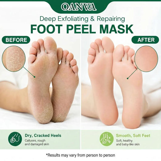 Oanva Foot Peeling Mask